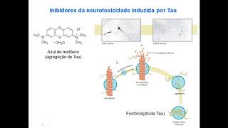 Aula4  Doença de Alzheimer Parte 2 [upl. by Sanford]