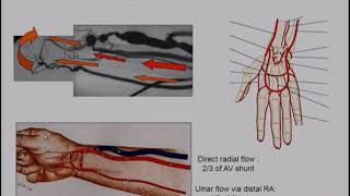 imagerie non invasive des abords vasculaires [upl. by Isaiah]