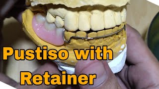 Pustiso with Retainer Lower Teeth [upl. by Kirrad]