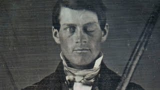 Why Scientists Are Still Fascinated By Phineas Gage [upl. by Steck]