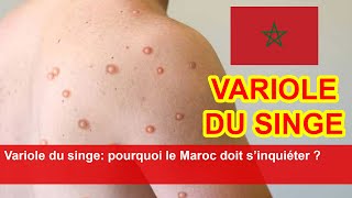 Variole du singe pourquoi le Maroc doit s’inquiéter [upl. by Hadden]