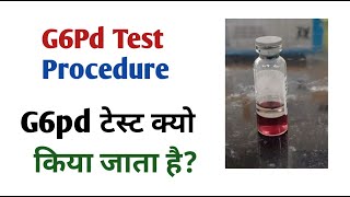 what is g6pd I g6pd test in hindi I g6pd test [upl. by Kelula]