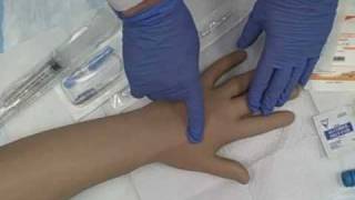 Intravenous IV Saline Lock Insertion [upl. by Herold]