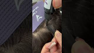 Ultra Thin Skin  Hair Replacement System  Natural amp Realistic Looking  Solution to Male Hair Loss [upl. by Aleen]