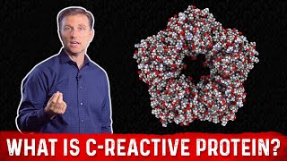 What is CReactive Protein amp How to Lower it – Dr Berg [upl. by Rick272]