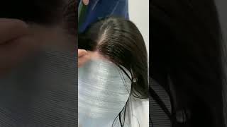 Receding hairline Dont miss this 🔥 Shop in description  Receding hairline patches [upl. by Gardas797]