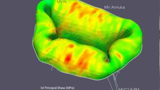 Mitral Valve Simulation [upl. by Jueta]