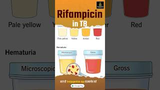 What is Rifampicin  Rifampicin in TB rifampicin nursing testpaperlivenursing shortvideo aiims [upl. by Janie]