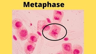 What happens during metaphase [upl. by Adnaloy]