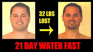 Water Fasting  Day 21 of 21  Breaking the Fast  Pictures Before After  32 lbs lost [upl. by Tait]