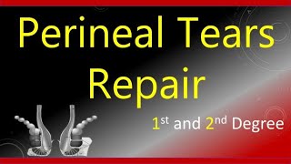 Perineal Tears Repair First and SecondDegree  TOACS  OSCE Station [upl. by Alohcin]