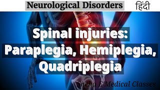 Spinal injuries Paraplegia Hemiplegia Quadriplegia  Hindi [upl. by Akiv141]