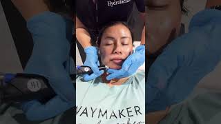 Hydra Facial done on me hydrafacial spa whittier uptownwhittier esthetician facialroller la [upl. by Roosevelt]