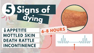 How to recognize a dying patient  5 signs of approaching death [upl. by Ulrick]