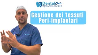 Gestione dei Tessuti Periimplantari l’Approccio di Dental One🦷 Dottor Vittorio Magnano [upl. by Maltz]