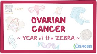 Ovarian cancer Year of the Zebra [upl. by Eirallam]