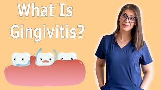 What Is Gingivitis  How To Treat Gingivitis [upl. by Utter]