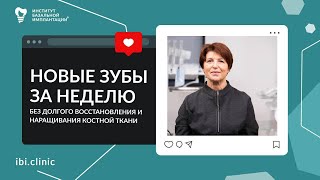 Отзыв пациента о базальной имплантации Лечение жевательных сегментов Клиника ИБИ в Москве [upl. by Leanard740]