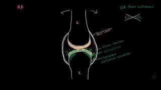 Osteoartrit ve Romatoid Artrit Patofizyolojisi Fen Bilimleri Sağlık ve Tıp [upl. by Anyr647]