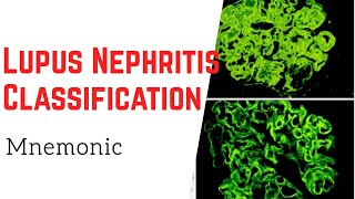 How to remember 6 classes of Lupus Nephritis Mnemonic [upl. by Ecirtael]