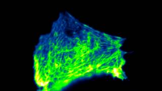 Effect of Latrunculin A on actin [upl. by Ayardna]