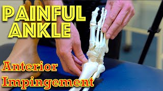 Ankle Pain  Anterior Impingement  Dr Gill [upl. by Mungo]