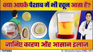 पेशाब में खून क्यों आता है  Hematuria Treatment  पेशाब में खून के कारण और जाँच से जुड़ी जानकारी [upl. by Anidan853]