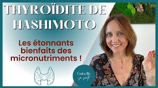 Hypothyroïdie d’Hashimoto régime alimentaire et solutions naturelles [upl. by Pallas455]