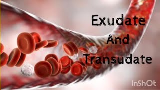 Exudate and Transudate  Basic Pathology [upl. by Tabby]