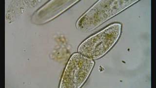 Paramecium Dividing [upl. by Anelegna455]