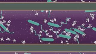 Explainer How does cholera affect your body [upl. by Stanford]