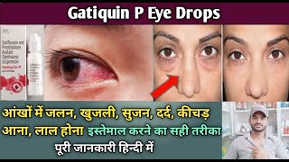 Gatiquin P drops use dose benefits and Side effects full review in hindi [upl. by Lleksah446]