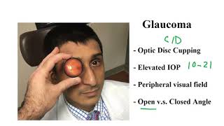 USMLE ACE Video 218 Glaucoma Optic Disc Changes Intraocular Pressure and Angle Classification [upl. by Lamson]