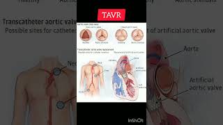 TVAR viralshort education norcetstudytips biology allaboutnorcet lifescience norcetseries [upl. by Lajet178]