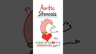 Aortic Stenosis AS  Valvular Heart Disease VHDscience doctor nurse cardio mbbs nclex [upl. by Mathilda]