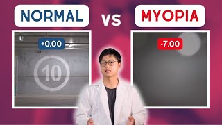 MYOPIA vs normal vision POV [upl. by Wittenburg]