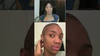 Rosemary oil for hair growth hairloss alopecia naturalhaircare 4chair hairregrowthoil [upl. by Alihet626]