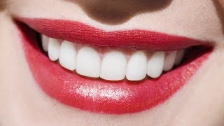 Essa Prótese Dentária de Silicone Removível São Tipo As Snap on Smile [upl. by Moe]