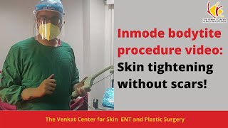 Skin Tightening with InMode How it Works Explained fully through BodyTite Treatment [upl. by Aisile]