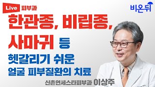 한관종 비립종 사마귀 등 헷갈리기 쉬운 얼굴 피부질환의 치료 신촌연세스타피부과 이상주 [upl. by Slrahc]