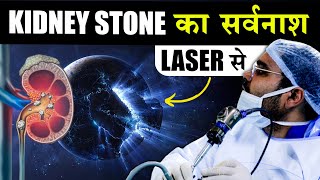 Kidney Stone Laser Surgery  VLOG [upl. by Alicsirp]