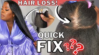 Yikes Im Losing My Hair  TEXTURED Tape In EXTENSIONS on Fine Hair with Hair Loss ft YWigs [upl. by Mima21]