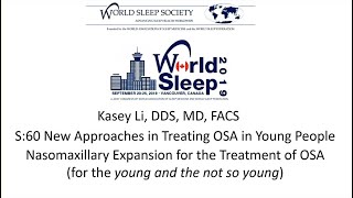 Kasey Li Maxillary expansion using endoscopicassistedsurgical expansion  World Sleep 2019 [upl. by Aneehsram]