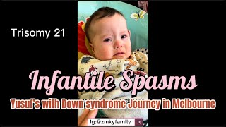 perjalanan Infantile spasms Yusuf epilepsi pada anak Down syndrome [upl. by Alejo594]