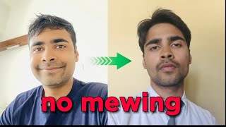 How I developed a Jawline in 30 days no mewing [upl. by Shaddock]