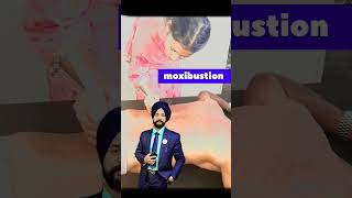 MoxibustionPrabh pain ramove Therapist solution foreverpunjabi [upl. by Dirrej]