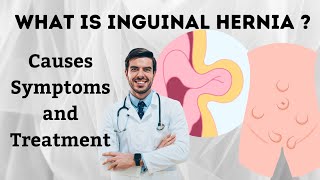 What is Inguinal Hernia  Inguinal Hernia Causes  Inguinal Hernia Symptoms and Best Treatment male [upl. by Heeley]