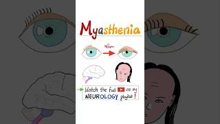 Myasthenia Gravis MG  Muscle Weakness Fatigue…science anatomy pathology health nurse mbbs [upl. by Wooster]