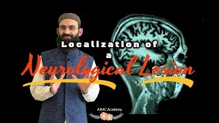 Localization of a Neurological Lesion Part I  Introduction [upl. by Sidnal317]