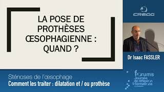 Dr FASSLER  Sténoses de l’oesophage  comment les traiter dilatation etou prothèse [upl. by Augustine]